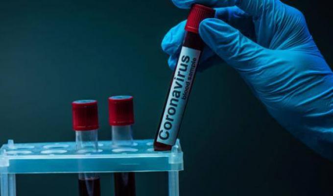 На Луганщині лабораторно підтверджено 25 нових випадків COVID-19 