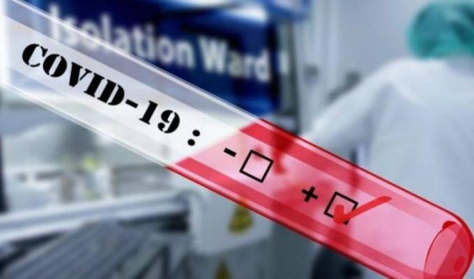 Лабораторно підтверджено 34 нових випадки COVID-19 в області