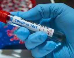 В області зафіксовано 43 нових випадки COVID-19. В Україні черговий антирекорд – 4069 за добу