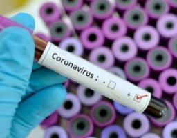 Лабораторно підтверджено 161 новий випадок COVID-19 в області